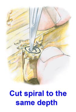 Spiral Cut Technique for Rubber Molds